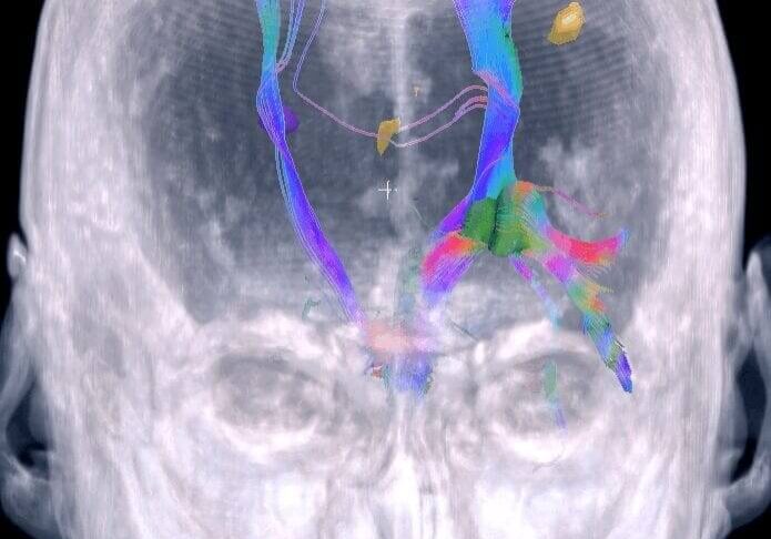 RightHandMove3D_SC-2-e1564685558930-3-3-695x903